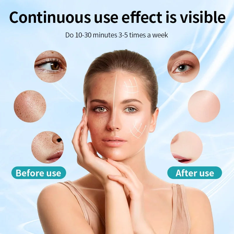 Glow-Up LED Skin Therapy Mask