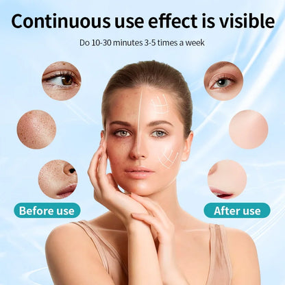 Glow-Up LED Skin Therapy Mask